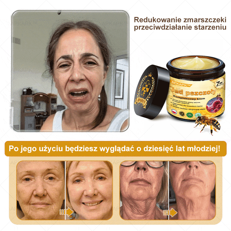 ΑPΚΑPK® Jad Pszczoły Kompleksowy Krem🔥🔥pomaga w leczeniu problemów skórnych, takich jak: zmarszczki, blizny, plamy pigmentacyjne, rozstępy, trądzik, łuszczyca, egzema, zmiany skórne, podrażnienia, stany zapalne i inne problemy skórne🔥