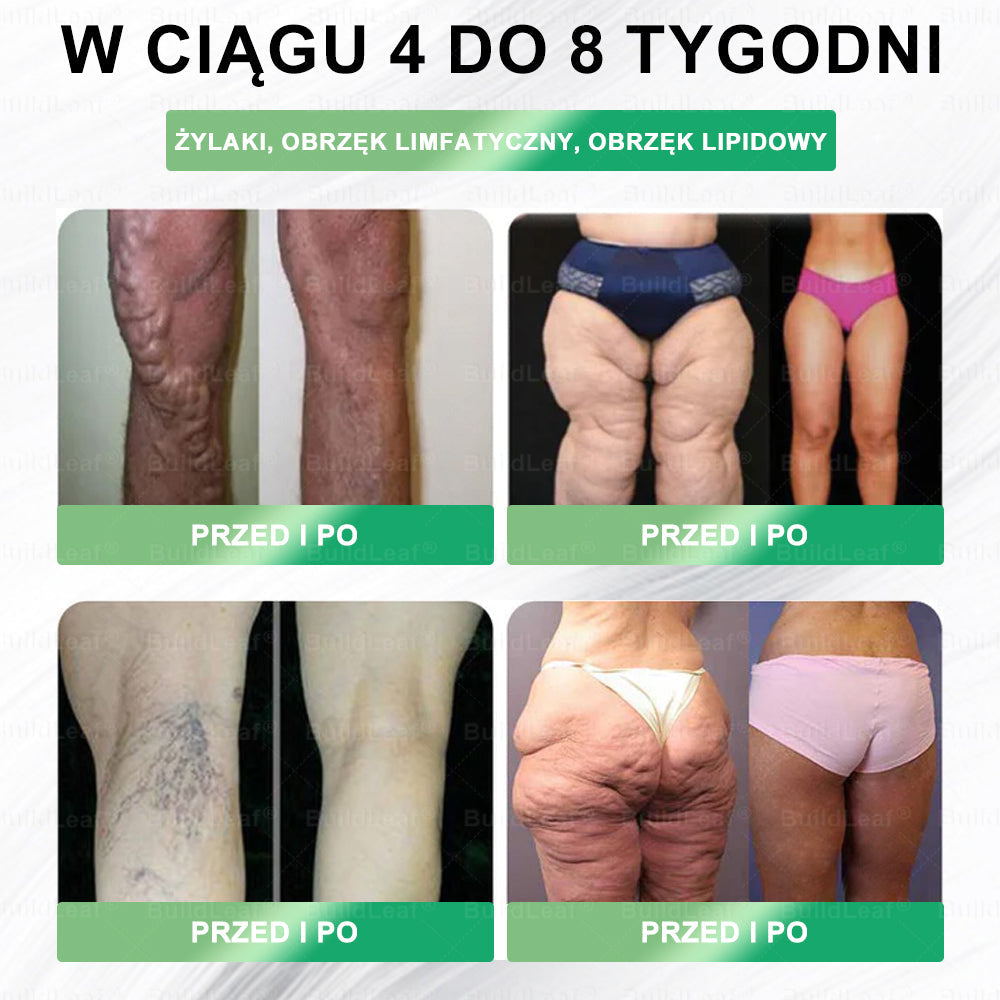🌸 Zostało dosłownie tylko 5 pudełek! Teraz dorzucamy jeszcze dodatkową zniżkę –50%! 💥 To Twoja szansa, aby zadbać o zdrowsze i lżejsze ciało. Jeśli przegapisz tę okazję, następna dostawa dopiero w przyszłym roku! 🚀 BuildLeaf®