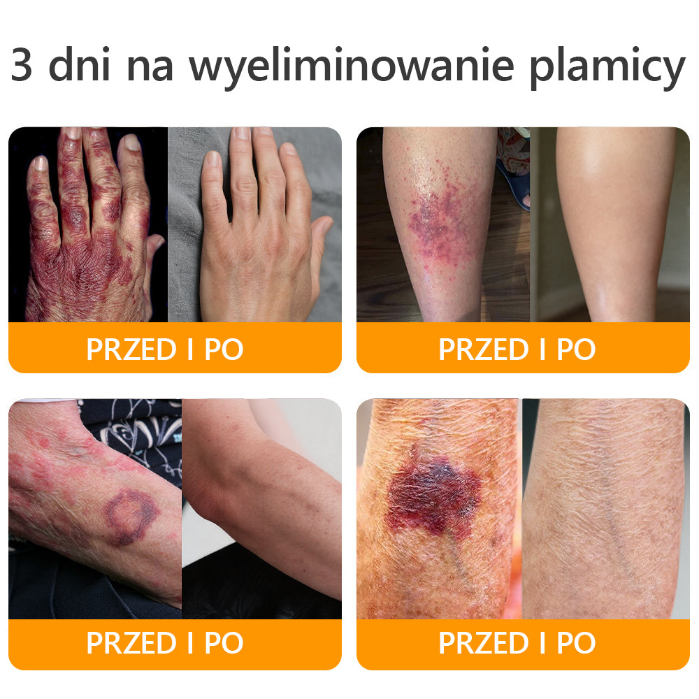 ΑPΚΑPK® Jad Pszczoły Kompleksowy Krem🔥🔥pomaga w leczeniu problemów skórnych, takich jak: zmarszczki, blizny, plamy pigmentacyjne, rozstępy, trądzik, łuszczyca, egzema, zmiany skórne, podrażnienia, stany zapalne i inne problemy skórne🔥
