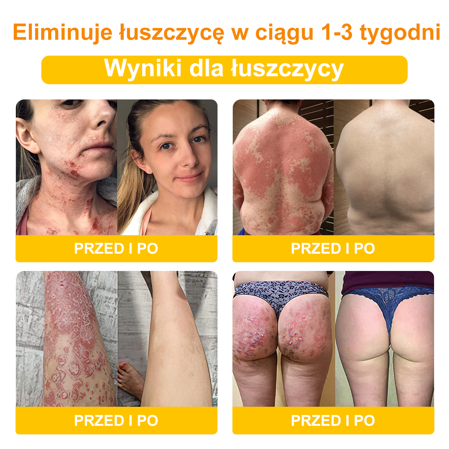 🐝Turonu™ Krem leczniczy z jadem pszczelim(🔥Ostatni dzień promocji 80% taniej)