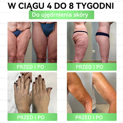 🖤🔥 Black Friday | Oficjalny sklep 👩‍⚕️ BuildLeaf® GLP-1 8-w-1 roztwór doustny (raz dziennie, efekty w 7 dni) Wspiera odchudzanie, serce, cukier, sen, jelita, stawy oraz ujędrnia skórę i dodaje energii