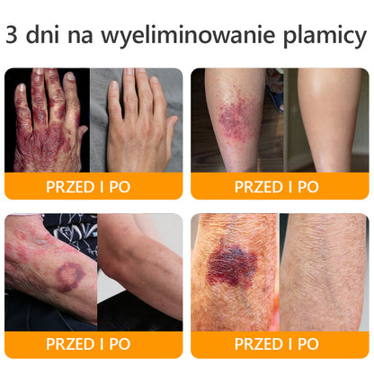 ΑPΚΑPK® Jad Pszczoły Kompleksowy Krem🔥🔥pomaga w leczeniu problemów skórnych, takich jak: zmarszczki, blizny, plamy pigmentacyjne, rozstępy, trądzik, łuszczyca, egzema, zmiany skórne, podrażnienia, stany zapalne i inne problemy skórne🔥